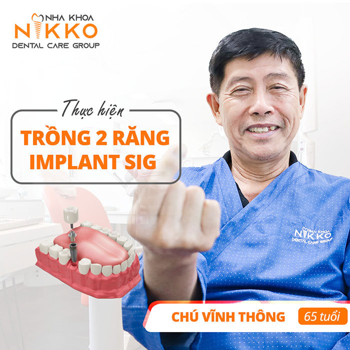 Chú Vĩnh Thông (65 tuổi) - cắm 2 trụ implant công nghệ sig nhật bản